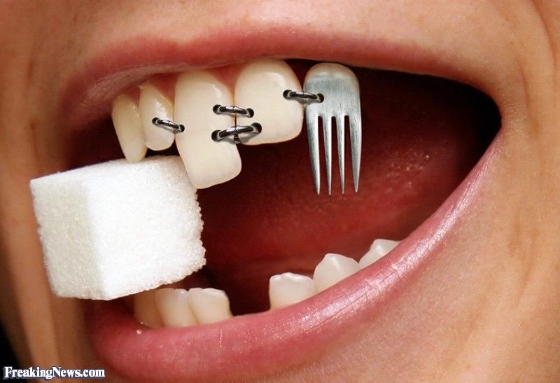 Fork Teeth Dental Implant 31190